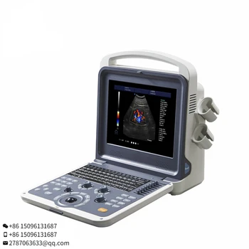 BT-UD11 bolnišnici veterinarski linearna sonda ultrazvok optičnega 4D Prenosni barvni doppler pralni pralni ultrazvok